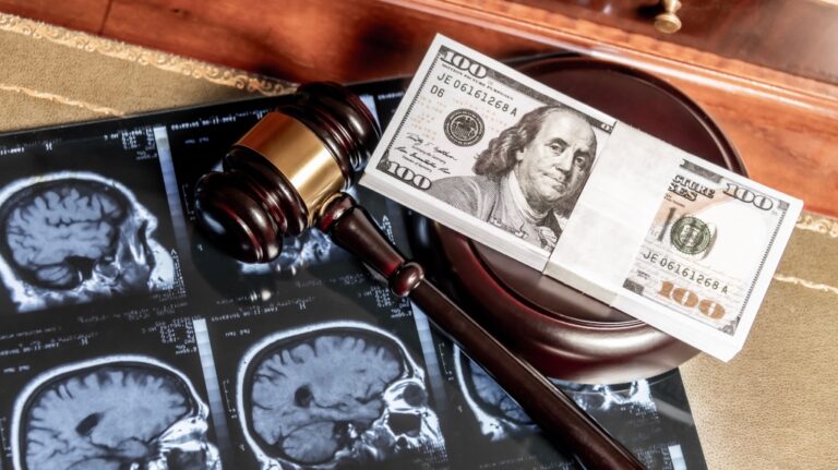 Gavel with brain scan and money