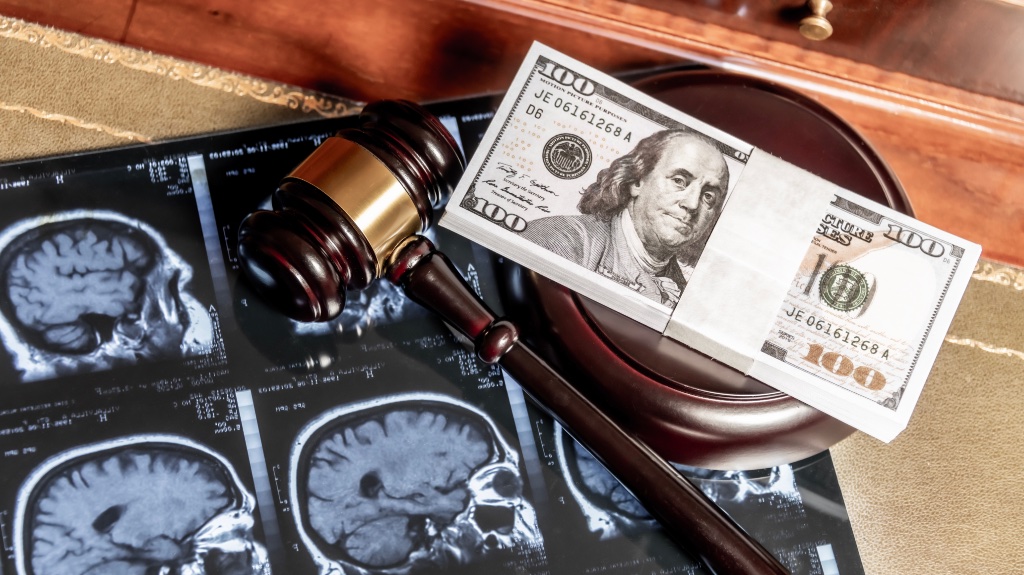 Gavel with brain scan and money