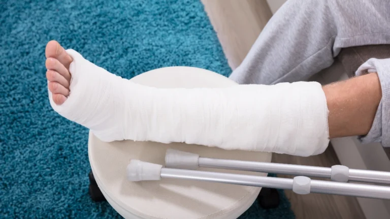 Person's leg in a white cast elevated on a stool with crutches resting nearby.