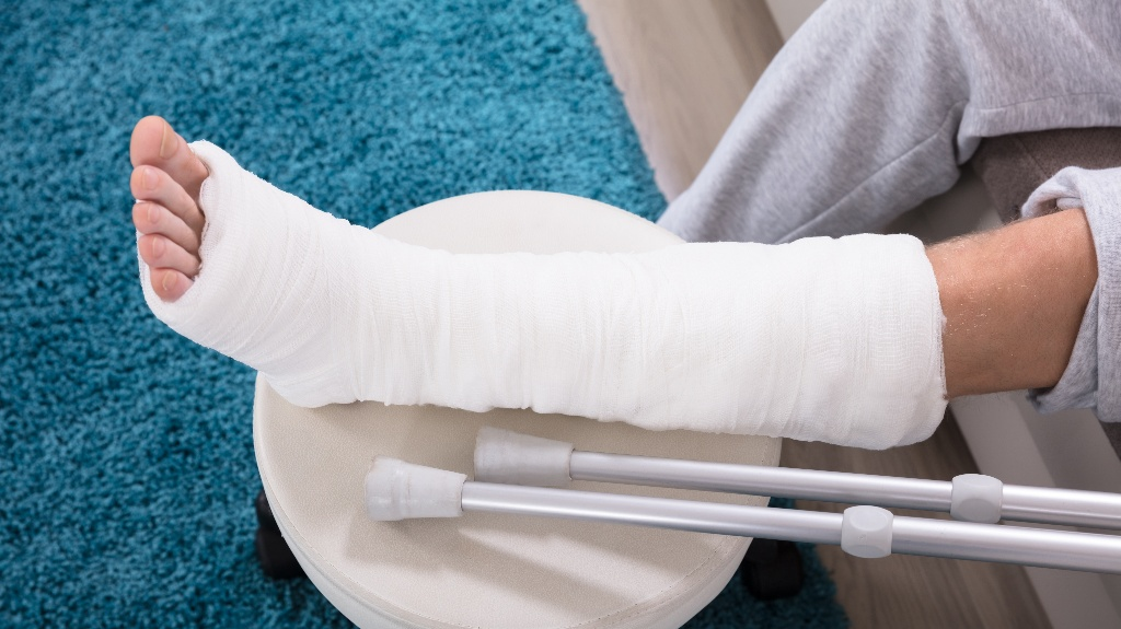 Person's leg in a white cast elevated on a stool with crutches resting nearby.