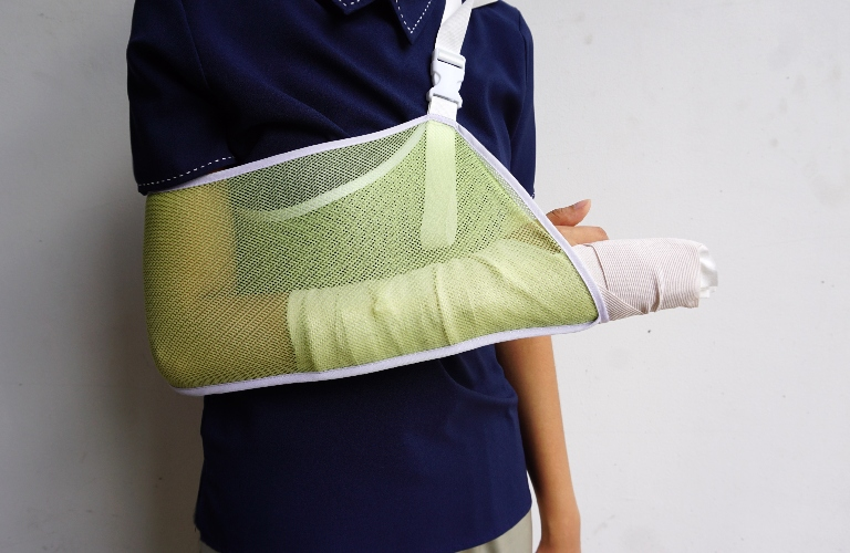 Person wearing a navy blue shirt with left arm in a green mesh sling and cast.